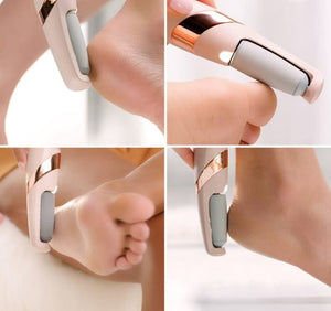 Foot callus remover being used on heels and toes